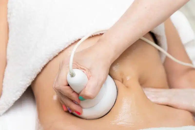 Body contouring treatment at Renova