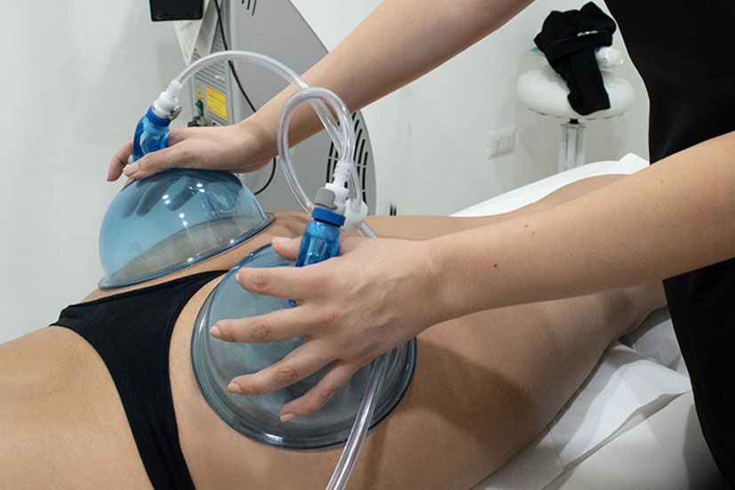 Non-surgical vacuum BBL treatment
